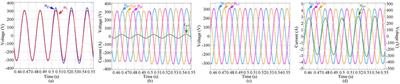 Voltage quality enhancement of distribution network based on unified power quality conditioner with BESS